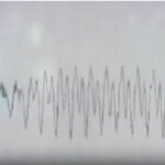 FREQUENZE